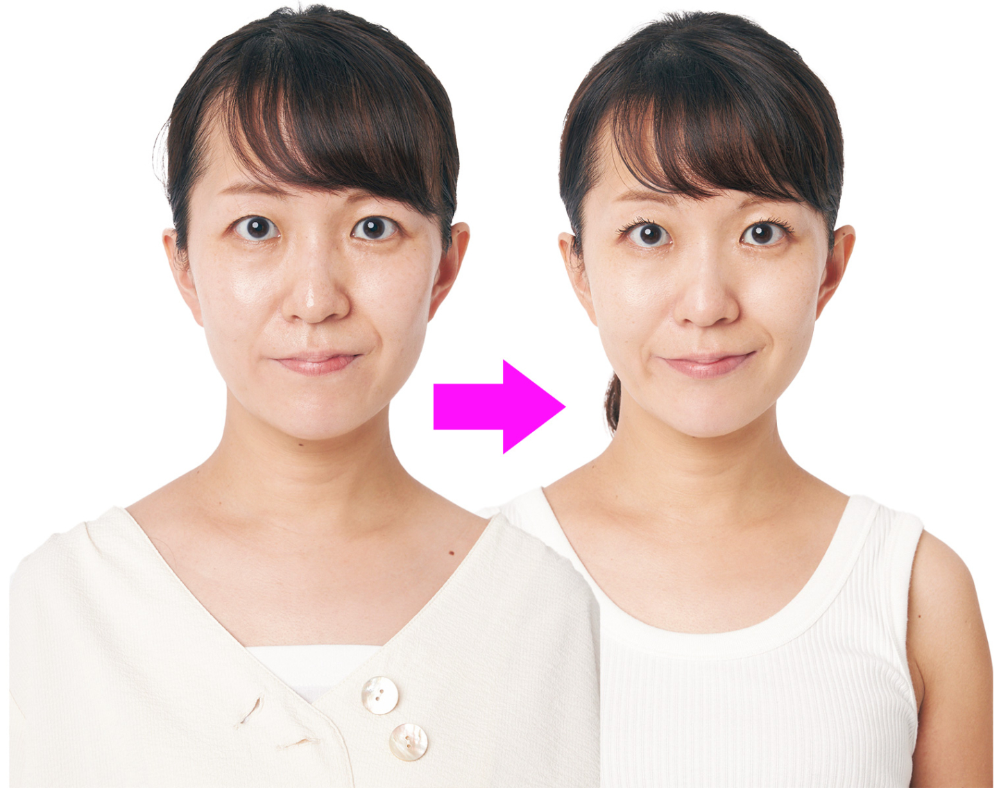 【顔にテープを貼って引き上げたみたい！】美容医療級の効果に驚いたコスメ