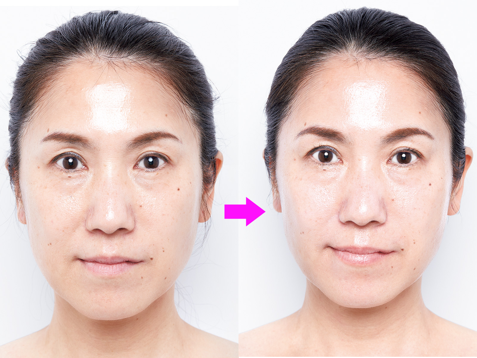 若見え実現、加齢によるたるみ・やぼやけた印象にさよなら！ 体験型全身美容液リッチリフト 若見え実現、加齢によるたるみ・やぼやけた印象にさよなら！ 体験型