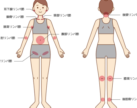 薬剤師に聞いた！顔や脚がパンパン…な「酷いむくみの解消方法」５選