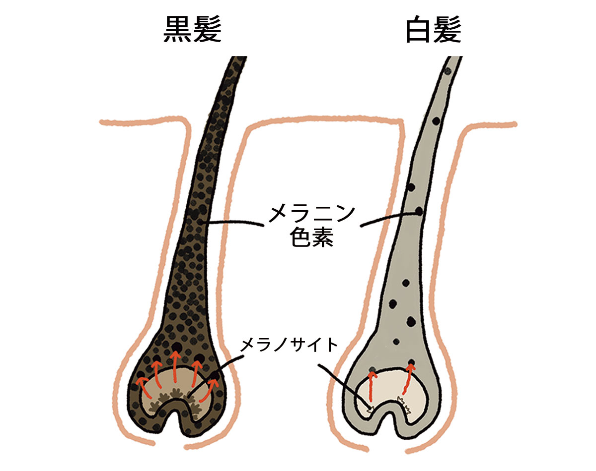 意外と知らない「白髪になる原因」を発毛専門医にぶつけてみたら…