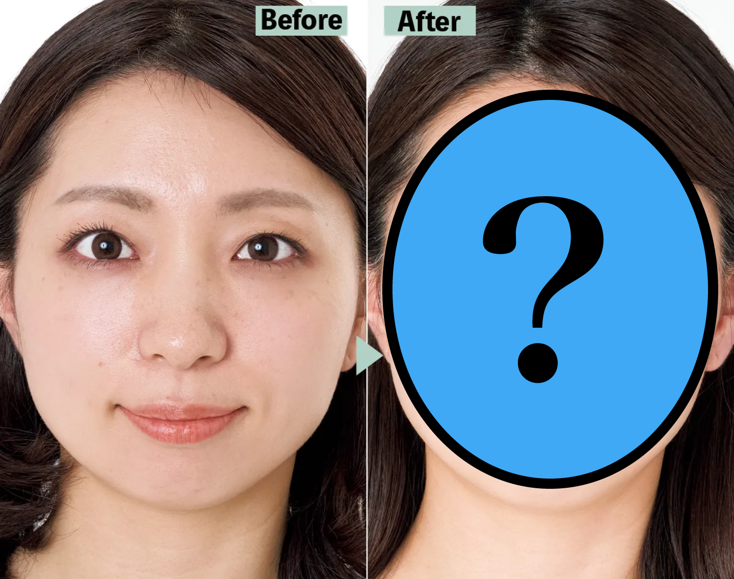 【Before→After】こまかいシミに悩む37歳読者が変身！いったい何をした？