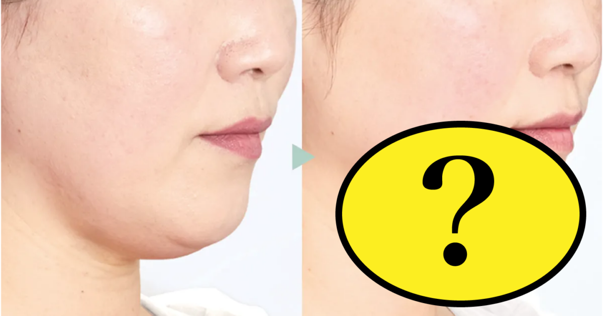 アゴになります Before→After】アゴ下が消えた!?読者もびっくりの方法がめっちゃ気に