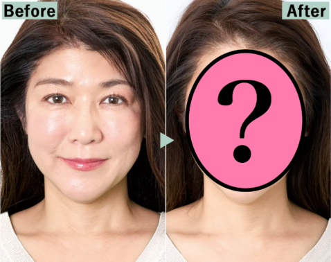 【Before→After】「痩せた？」と友人からの声が続出！いったい何が