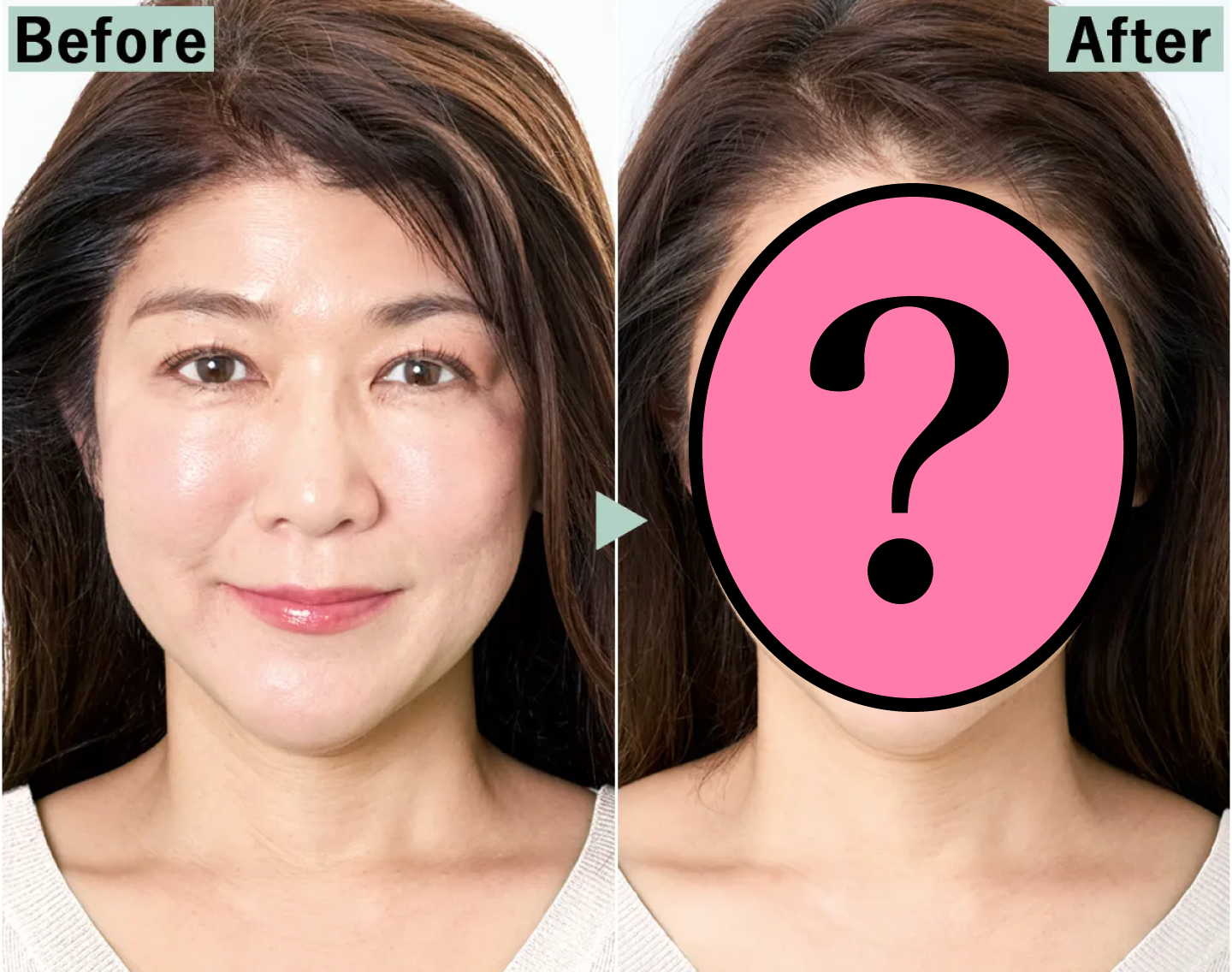 【Before→After】「痩せた？」と友人からの声が続出！いったい何が