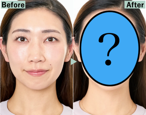 【Before→After】「５分足らずで、５年前の笑顔を取り戻した」と衝撃の声…