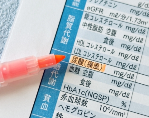 【更年期はリスク増】女性にも起こる「痛風」を防ぐには？薬剤師が教えるセルフケア5選