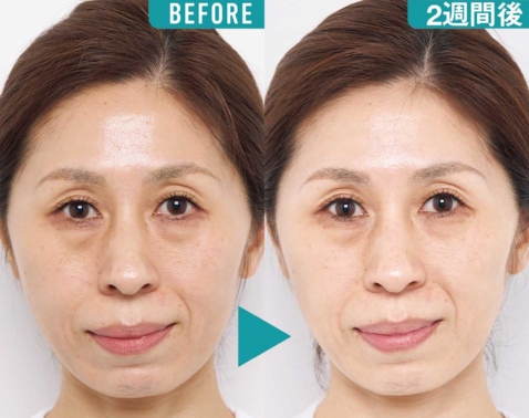 46歳読者が実感！1週間で小ジワが浅く、目の開きもアップした『最新アイケア』の底力