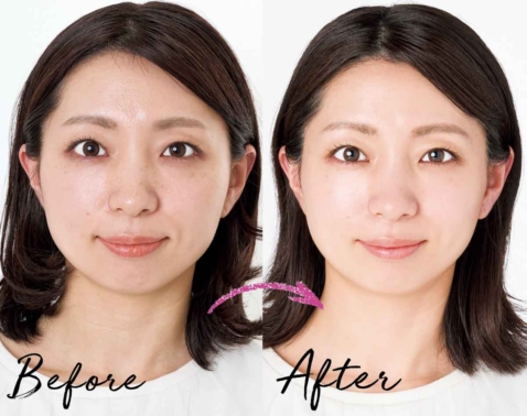 しつこいシミに！40代・50代が始めたい“コツコツ継続”でくすみレス肌に！【BeforeAfter】