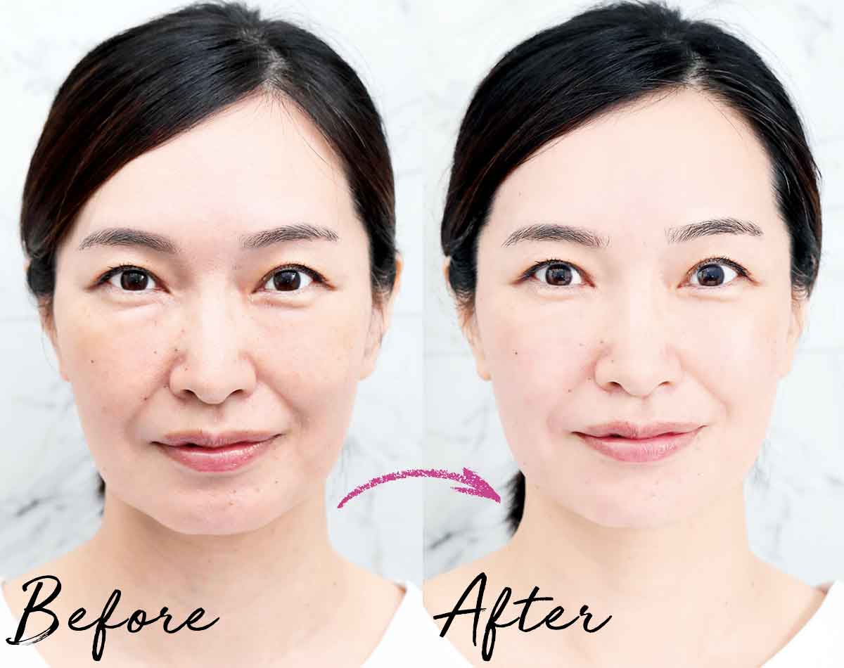 40代・50代の肌ハリツヤ不足に！話題の「噴射導入ミラジェット」とは