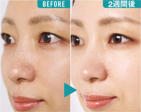 キメと透明感が一変！ベスコス受賞の2大名品を【読者が2週間試した結果】