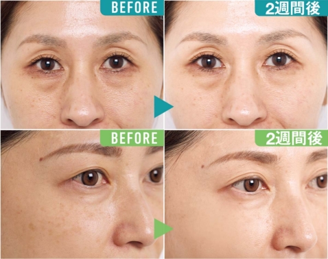 35〜52歳が2週間ガチ検証！ベスコス受賞スキンケア12選のBefore/After