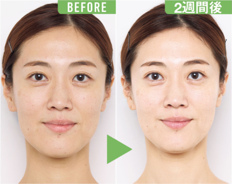 2週間で一発逆転！読者がお試しして分かった毛穴・キメのリセット神アイテム