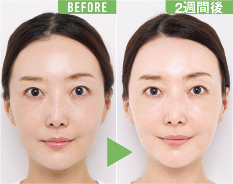 5日でツヤを実感！顔立ちまで引き締める「即戦力」のベスコスアイテム