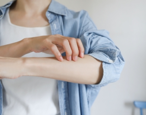肌にかゆみや赤みが出る【湿疹】はどう対処する？今日からできるセルフケア5選［医師監修］