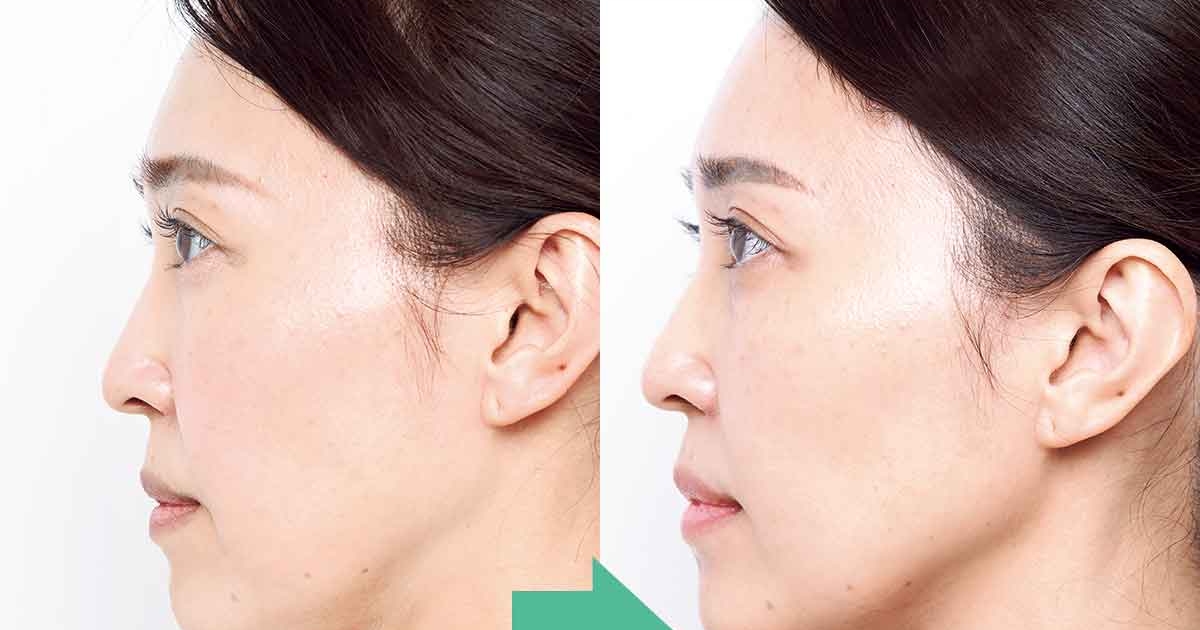 47歳が検証！顔の横幅・下がりを撃退し「老化で伸びた顔」を短縮 | 美