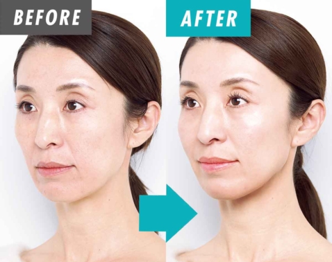 42歳読者も絶賛！家事の間に「目がパッチリ」若見えを育む最新EMS