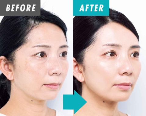 48歳が衝撃！頭皮ケアで叶える「凛とした小顔」と理想のライン