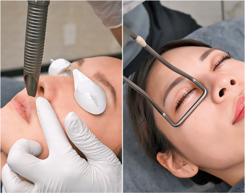 「面長になった」は老化のサイン！美女医が教える顔の間延び解消術