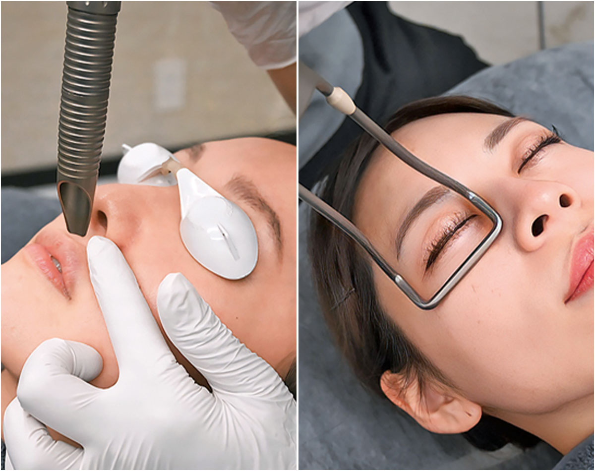 「面長になった」は老化のサイン！美女医が教える顔の間延び解消術