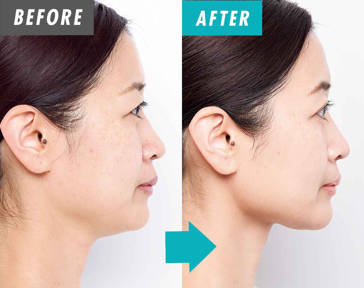 【38歳が激変】お風呂で小顔＆痩身！顔も体も引き締まる防水ギア