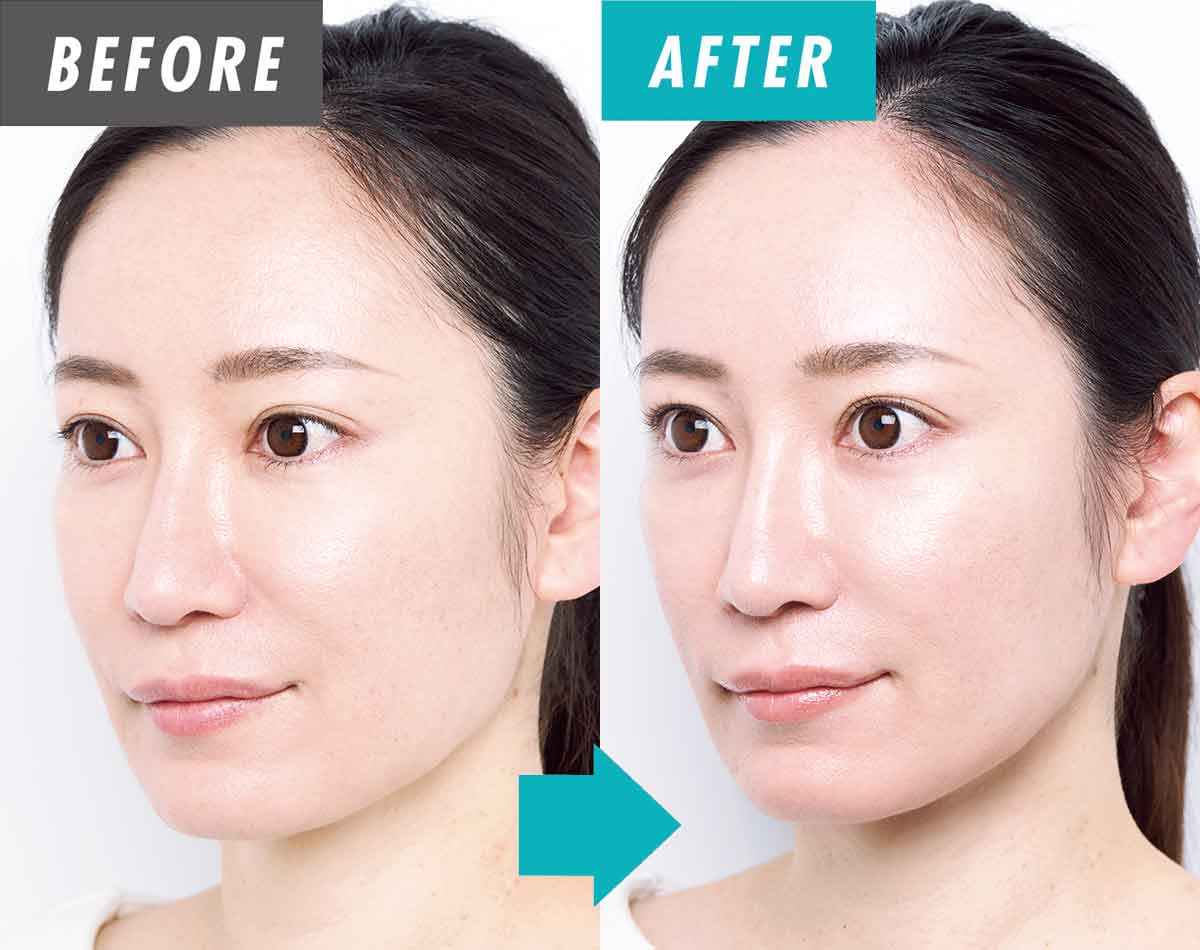 【42歳が検証】頬の位置が高くなった！ほうれい線を薄くする進化系パワーガン