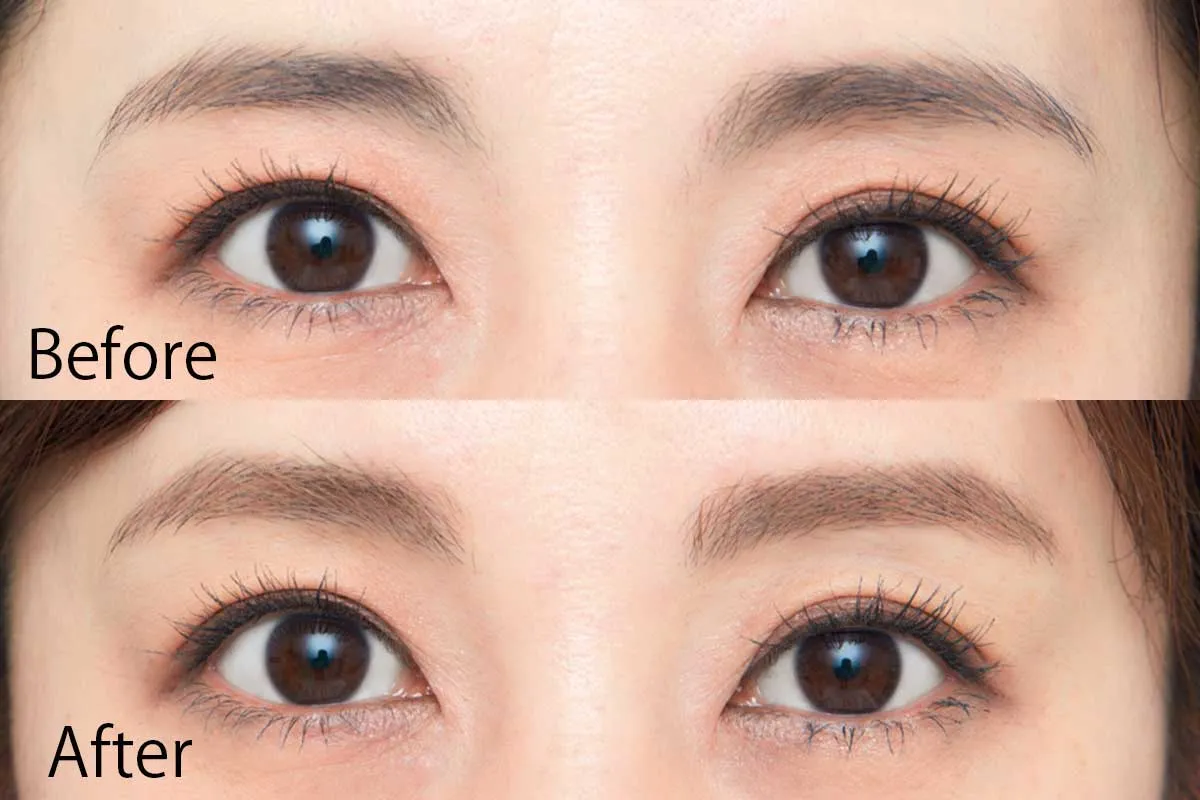濃い眉・ボサボサ眉 ビフォーアフター