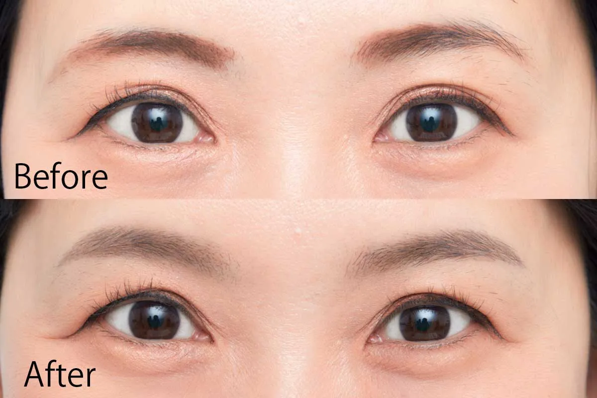 左右非対称眉 ビフォーアフター